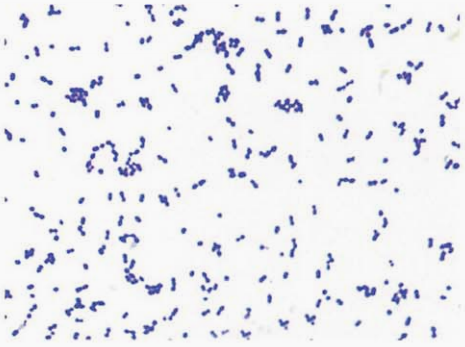 图 4 猪链球菌纯培养的镜下形态(革兰染色)