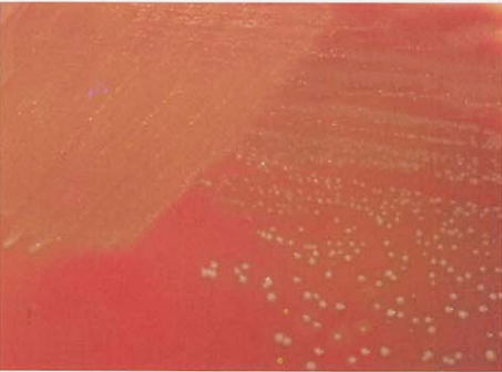 图 5 猪链球菌在血琼脂平板上的菌落特征(18~24h)