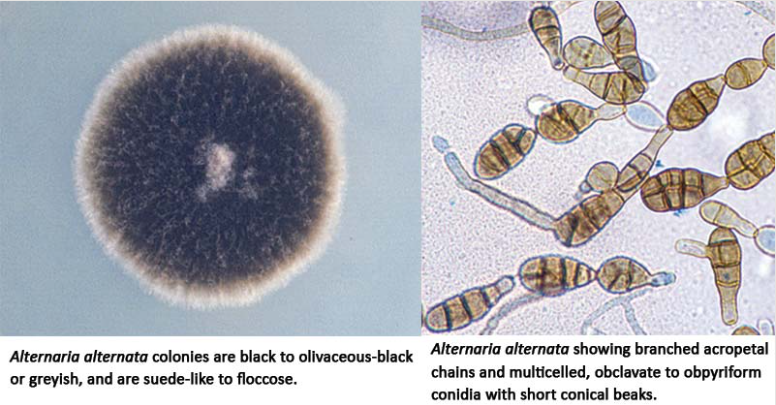 Alternaria alternata 呈现典型特征