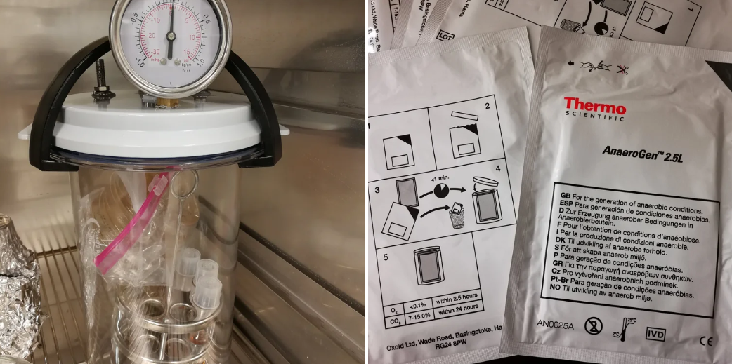 厌氧罐和产气袋