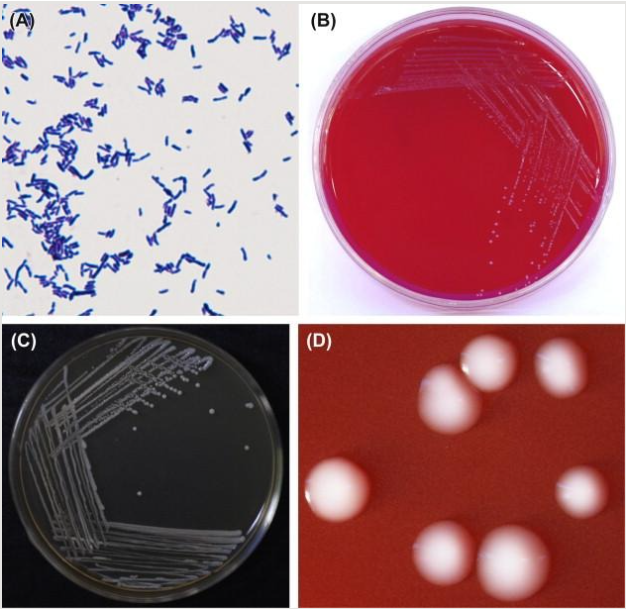 长双歧杆菌（Bifidobacterium longum）
