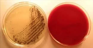艰难梭菌Clostridioides-difficile