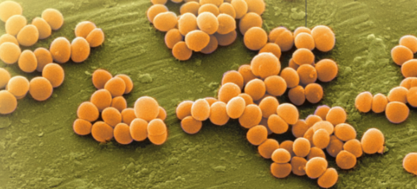 超级细菌 MRSA