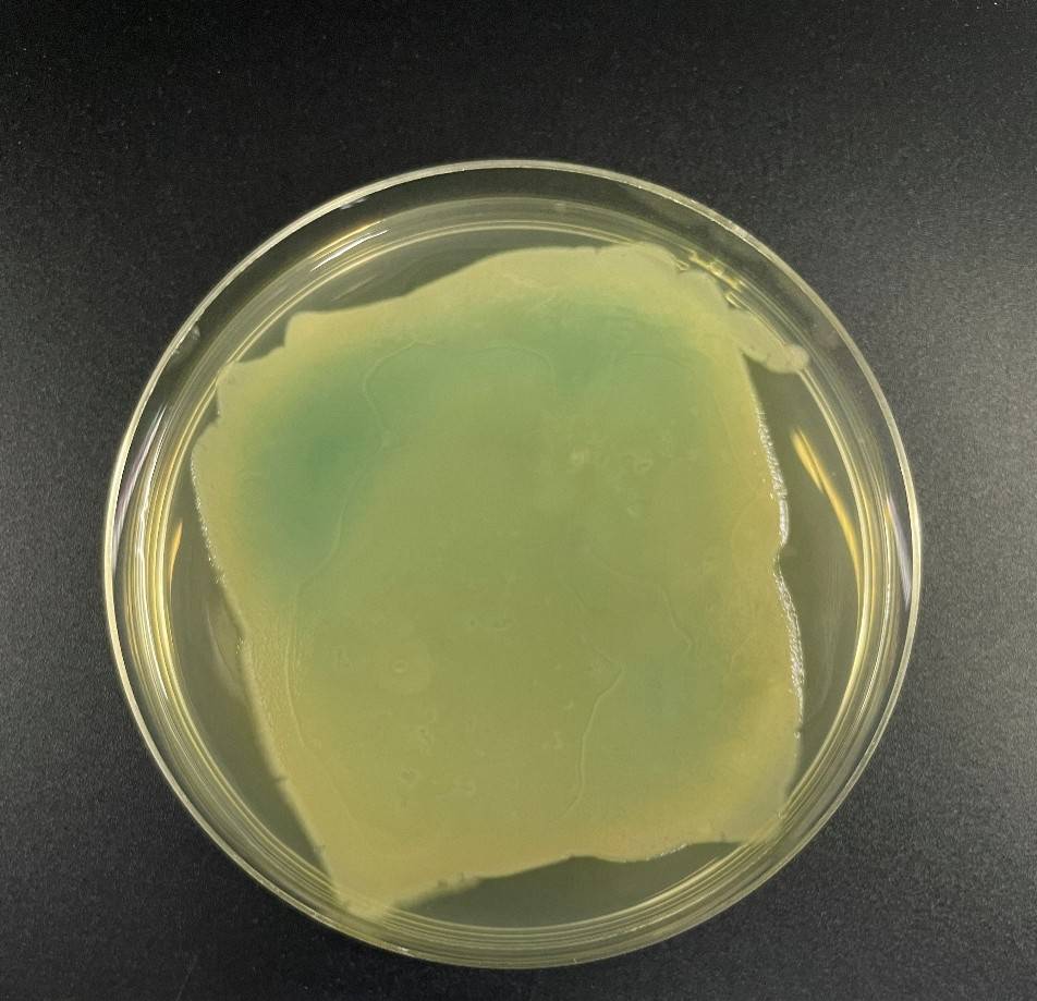 Pseudomonas aeruginosa