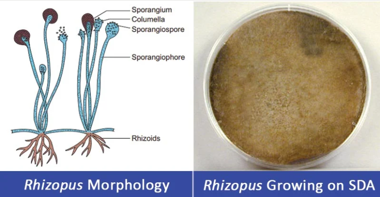 根霉属（Rhizopus spp.）