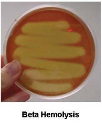 β溶血环