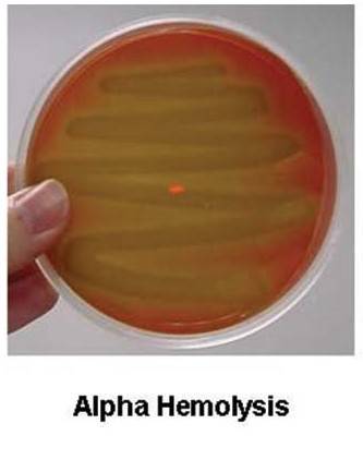 α-溶血
