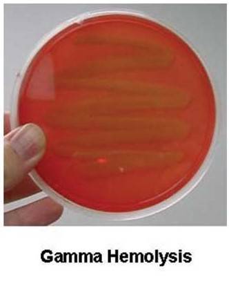 γ-溶血