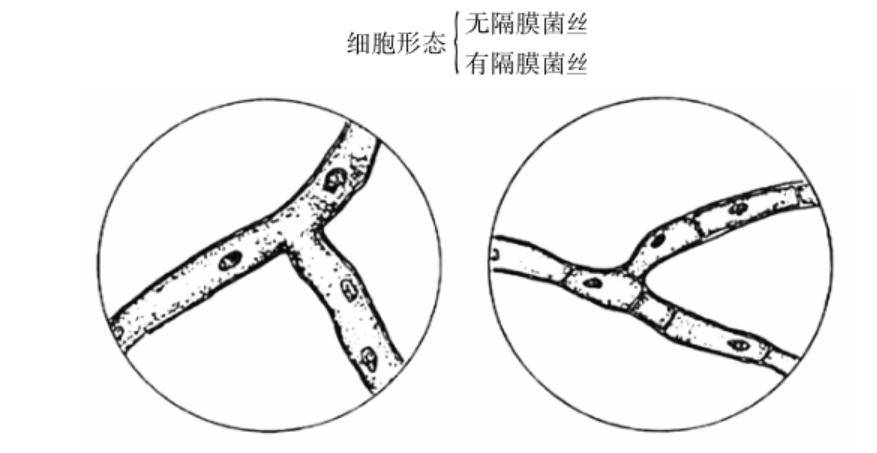 霉菌的有隔膜菌丝和无隔膜菌丝