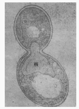 自酿酒酵母出芽的电镜截面图
