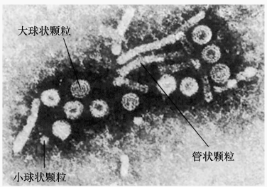 图 3 乙肝病毒的电镜照片