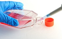 AAV_Production_in_HEK293T_Cells01.jpg