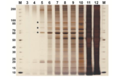 AAV_Purification_by_Iodixanol_Gradient_Ultracentrifugation04.jpg