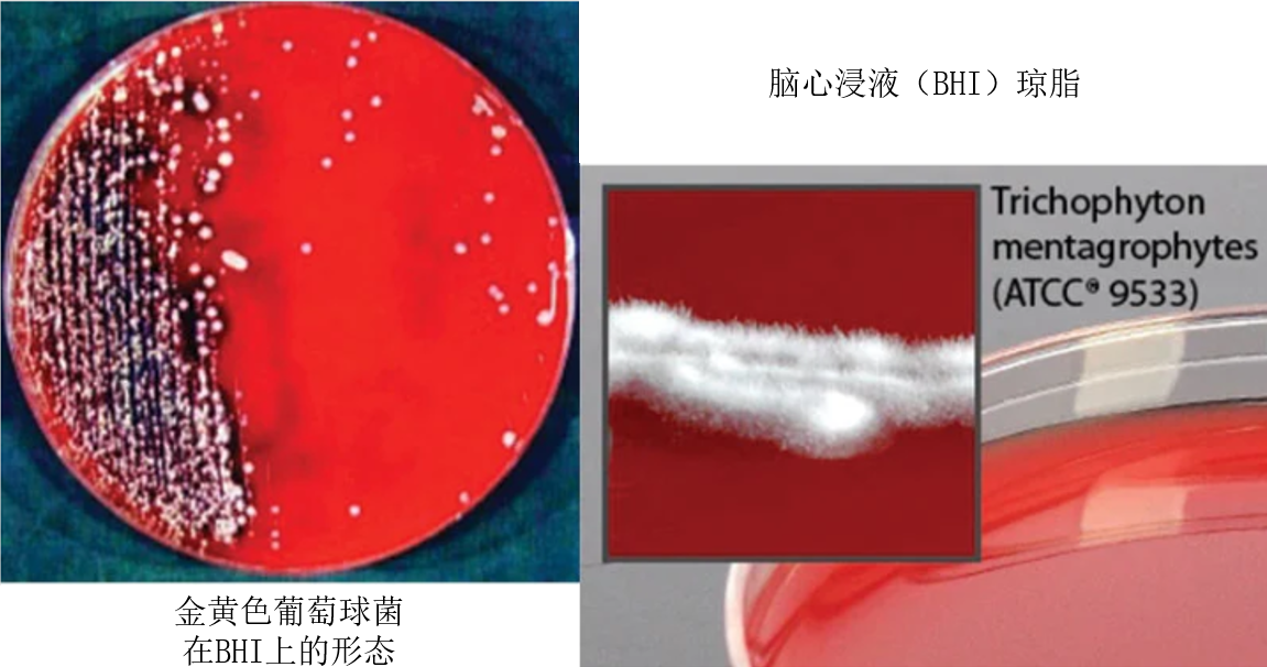 脑心浸液（BHI）琼脂